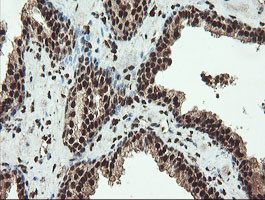 SAMHD1 Antibody in Immunohistochemistry (Paraffin) (IHC (P))