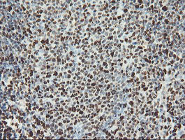 SAMHD1 Antibody in Immunohistochemistry (Paraffin) (IHC (P))