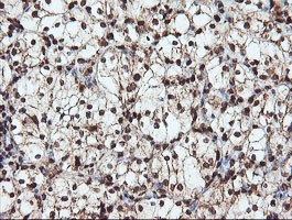 SAMHD1 Antibody in Immunohistochemistry (Paraffin) (IHC (P))