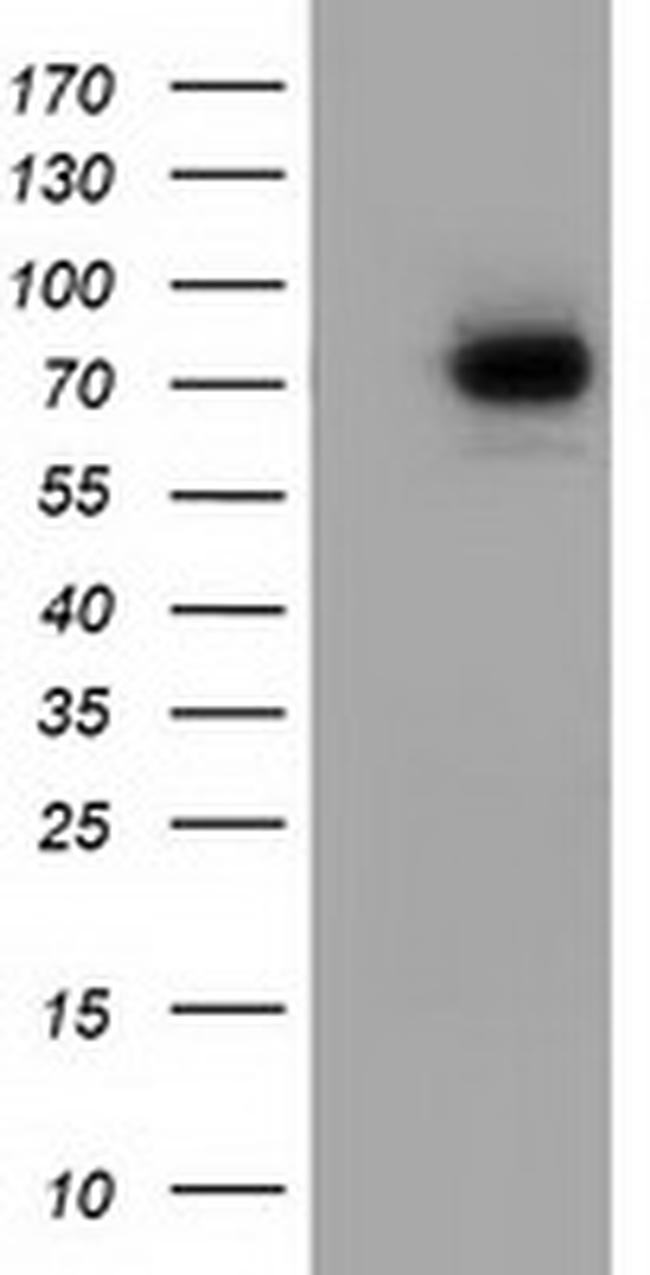 SAMHD1 Antibody in Western Blot (WB)