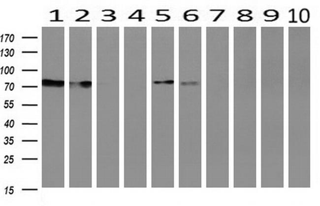 SAMHD1 Antibody in Western Blot (WB)