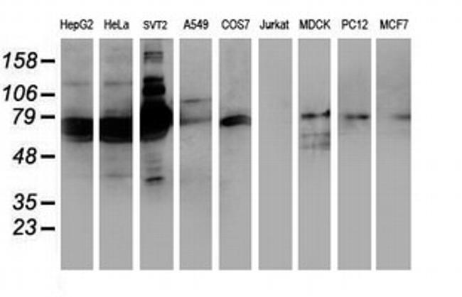 SAMHD1 Antibody in Western Blot (WB)