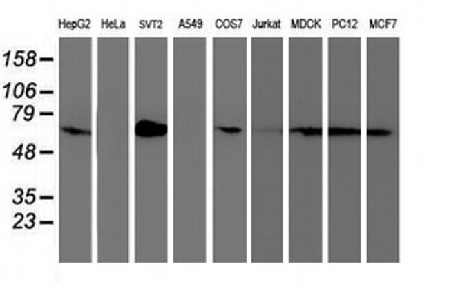 SAMHD1 Antibody in Western Blot (WB)