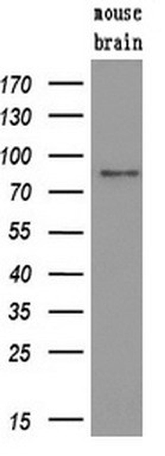 SAMHD1 Antibody in Western Blot (WB)