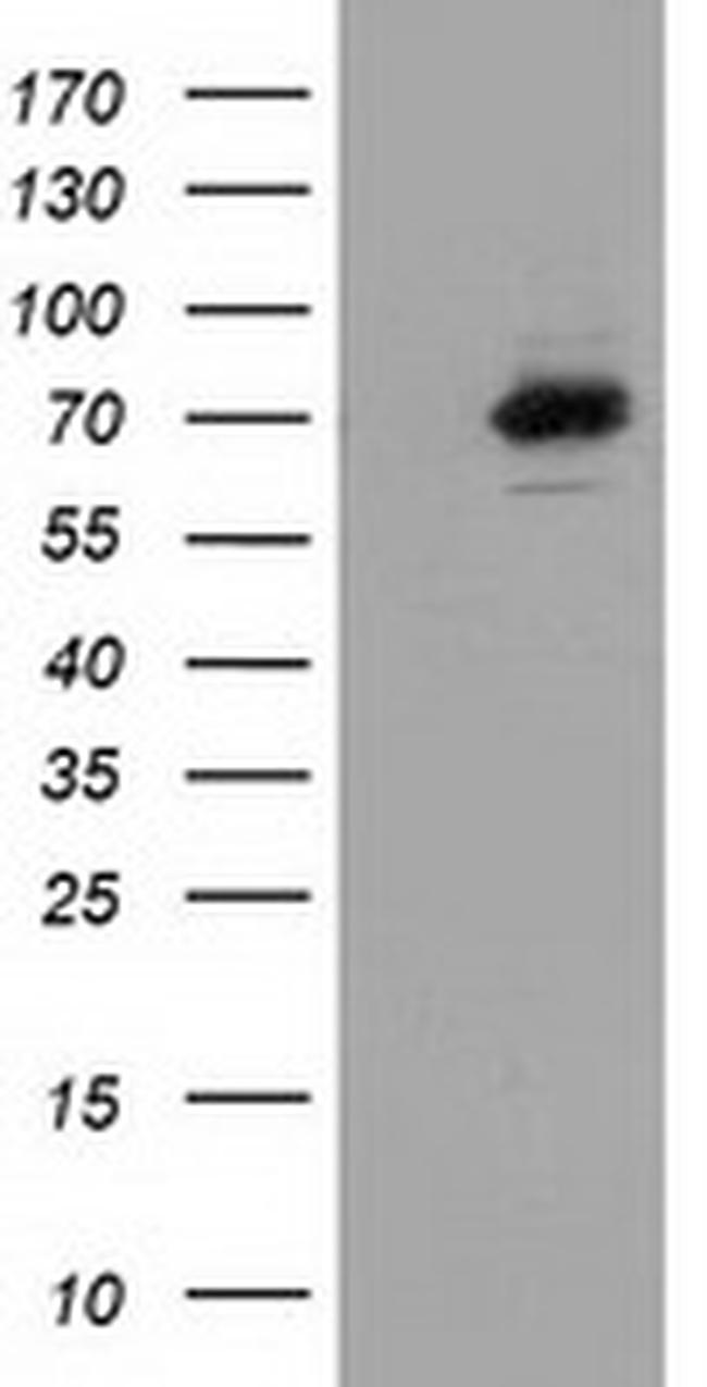 SAMHD1 Antibody in Western Blot (WB)