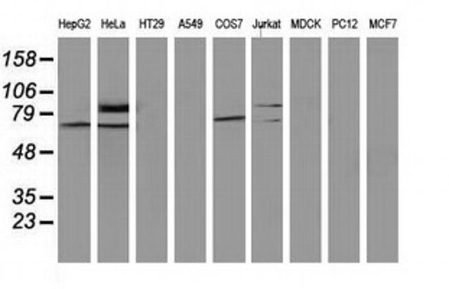 SAMHD1 Antibody in Western Blot (WB)