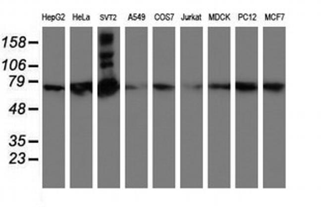 SAMHD1 Antibody in Western Blot (WB)