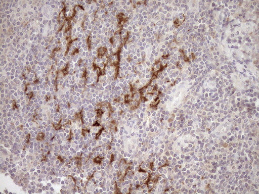 SAMSN1 Antibody in Immunohistochemistry (Paraffin) (IHC (P))