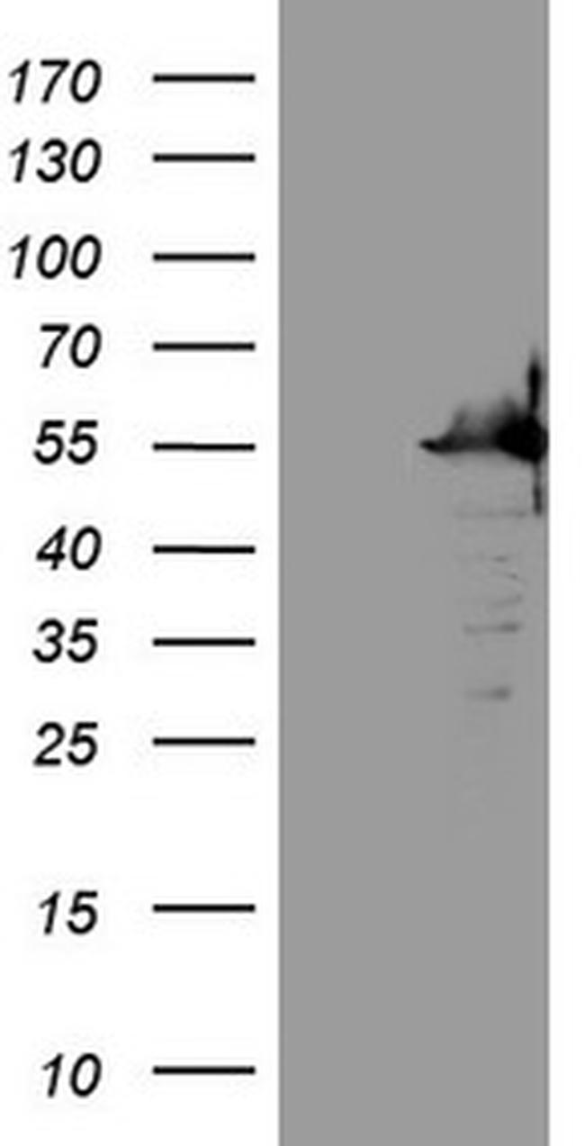 SAMSN1 Antibody in Western Blot (WB)