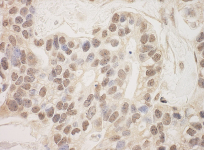 SAP130 Antibody in Immunohistochemistry (IHC)