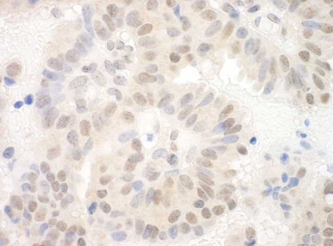 SAP130 Antibody in Immunohistochemistry (IHC)