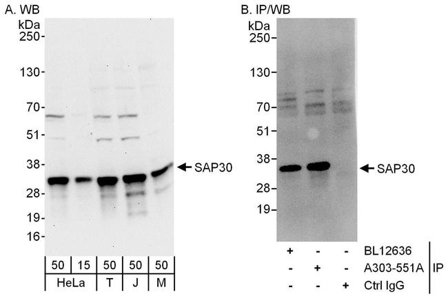 SAP30 Antibody in Western Blot (WB)