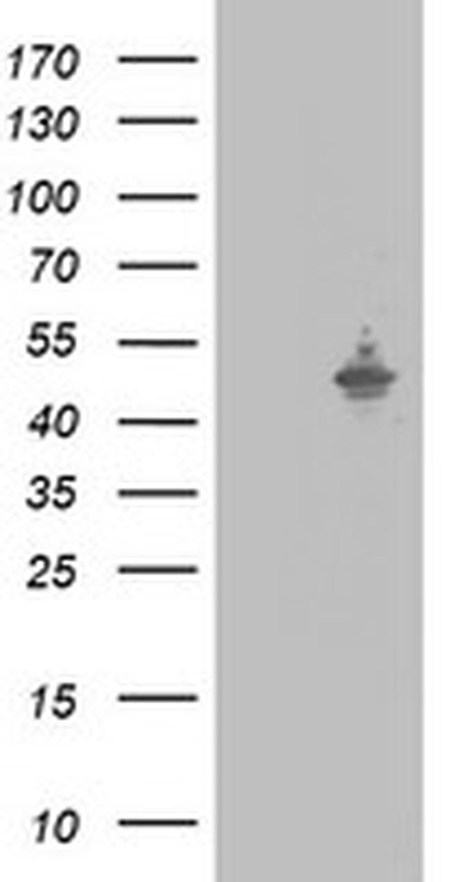 SAP30BP Antibody in Western Blot (WB)