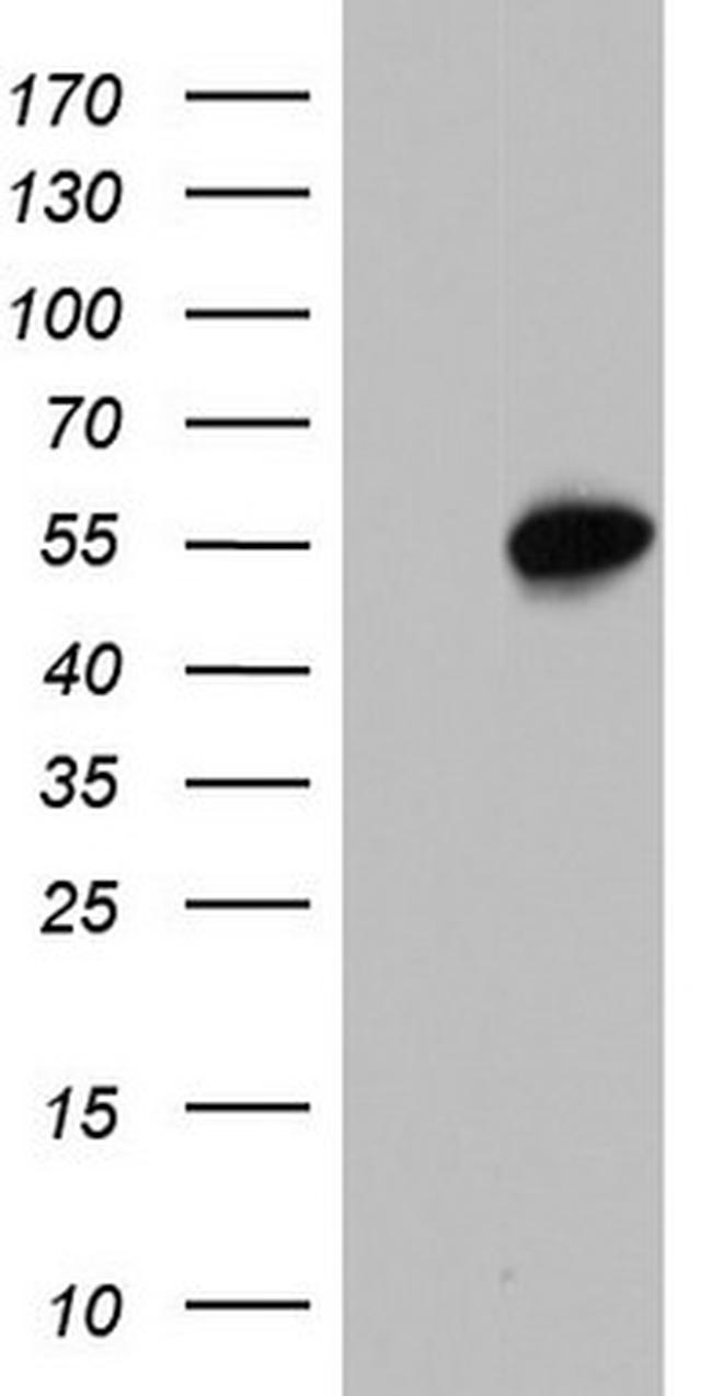 SAP30BP Antibody in Western Blot (WB)