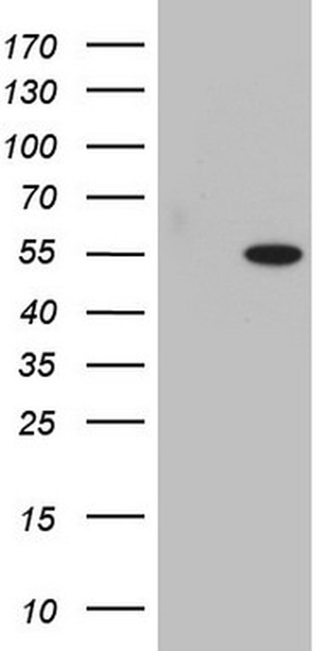 SAP30BP Antibody in Western Blot (WB)