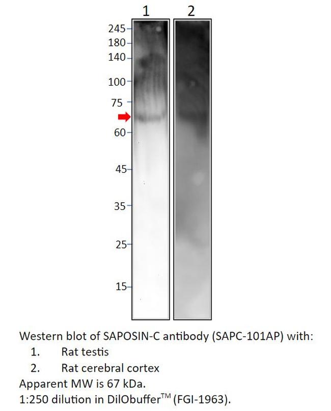 SAPOSIN-C Antibody in Western Blot (WB)