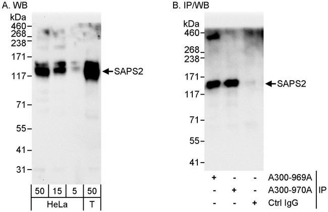 SAPS2 Antibody in Western Blot (WB)