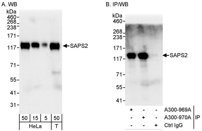 SAPS2 Antibody in Western Blot (WB)