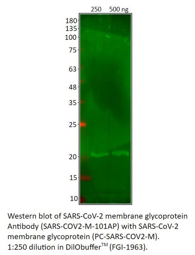 SARS-CoV-2 membrane glycoprotein Antibody in Western Blot (WB)