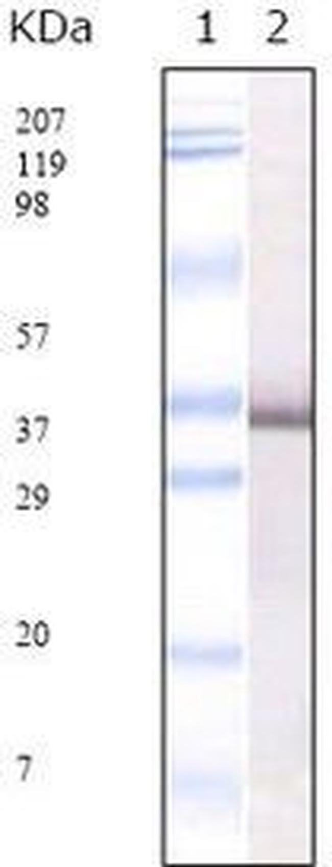 SARS Coronavirus E2 Antibody in Western Blot (WB)