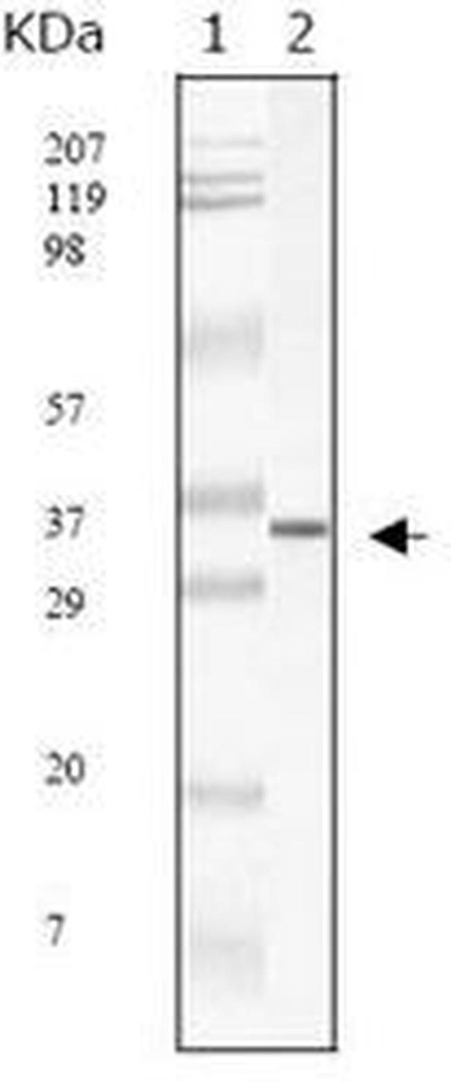 SARS Coronavirus Matrix Antibody in Western Blot (WB)