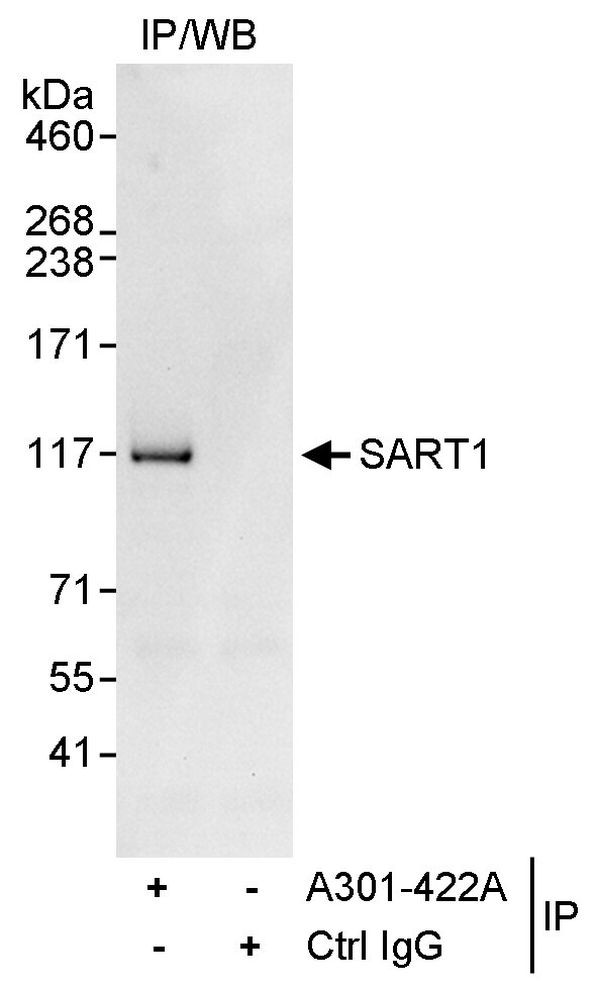 SART1 Antibody in Immunoprecipitation (IP)