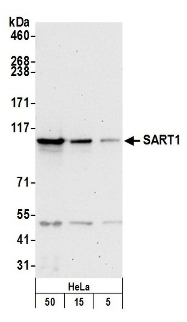 SART1 Antibody in Western Blot (WB)