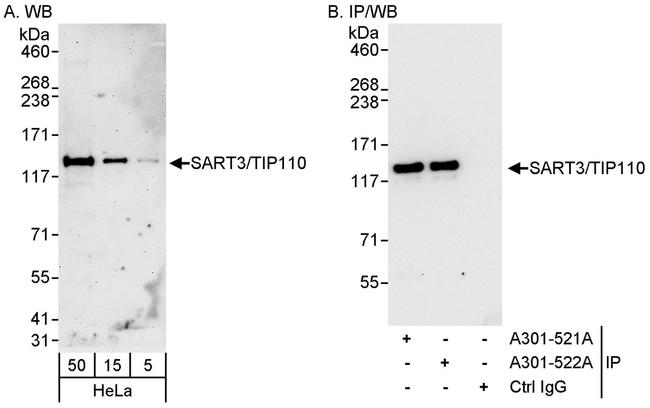 SART3/TIP110 Antibody in Western Blot (WB)