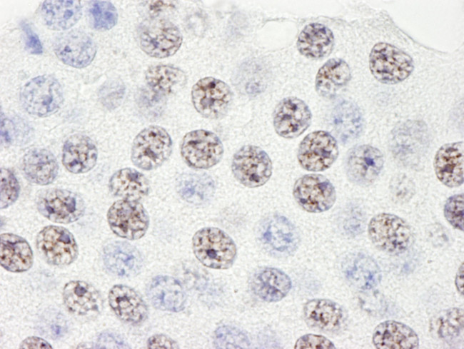 SART3/TIP110 Antibody in Immunohistochemistry (IHC)