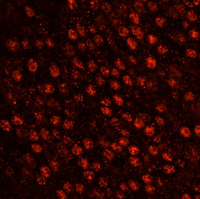 SART3/TIP110 Antibody in Immunohistochemistry (IHC)