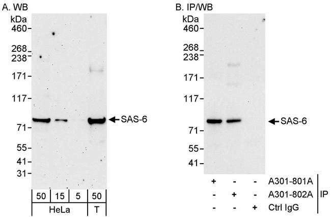 SAS-6 Antibody in Western Blot (WB)