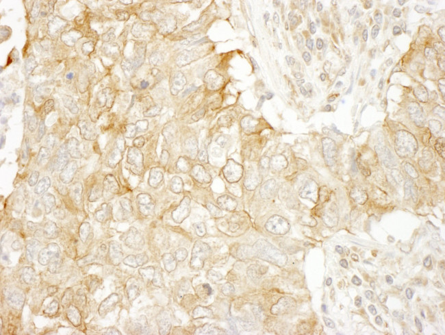 SASH1 Antibody in Immunohistochemistry (IHC)