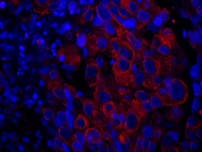 SASH1 Antibody in Immunohistochemistry (IHC)