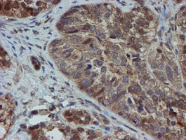 SAT2 Antibody in Immunohistochemistry (Paraffin) (IHC (P))