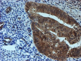 SAT2 Antibody in Immunohistochemistry (Paraffin) (IHC (P))