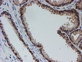 SAT2 Antibody in Immunohistochemistry (Paraffin) (IHC (P))