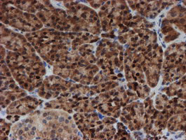 SAT2 Antibody in Immunohistochemistry (Paraffin) (IHC (P))