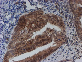 SAT2 Antibody in Immunohistochemistry (Paraffin) (IHC (P))