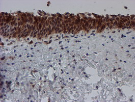 SAT2 Antibody in Immunohistochemistry (Paraffin) (IHC (P))