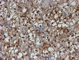 SAT2 Antibody in Immunohistochemistry (Paraffin) (IHC (P))