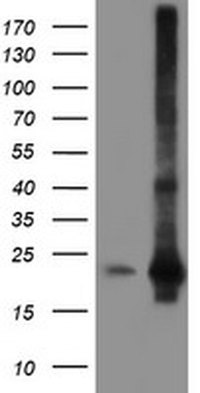 SAT2 Antibody in Western Blot (WB)