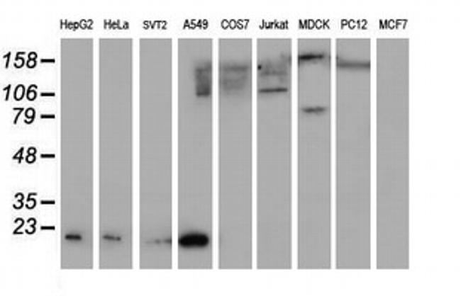 SAT2 Antibody in Western Blot (WB)