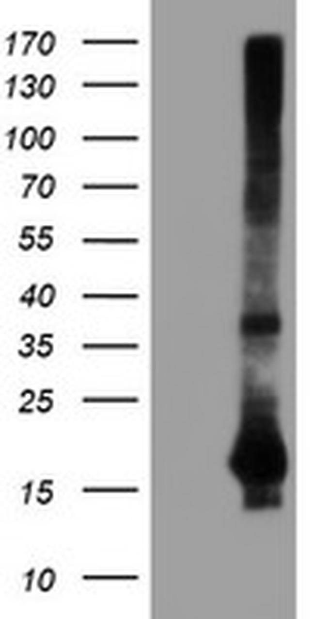 SAT2 Antibody in Western Blot (WB)