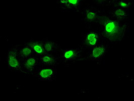 SATB1 Antibody in Immunocytochemistry (ICC/IF)