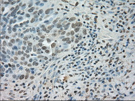 SATB1 Antibody in Immunohistochemistry (Paraffin) (IHC (P))