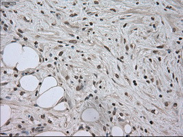 SATB1 Antibody in Immunohistochemistry (Paraffin) (IHC (P))