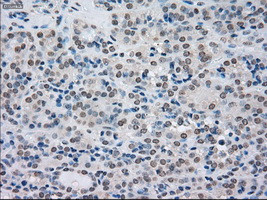 SATB1 Antibody in Immunohistochemistry (Paraffin) (IHC (P))