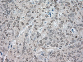 SATB1 Antibody in Immunohistochemistry (Paraffin) (IHC (P))