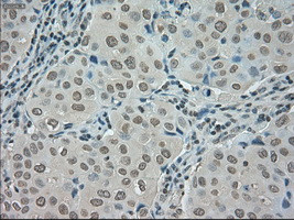 SATB1 Antibody in Immunohistochemistry (Paraffin) (IHC (P))