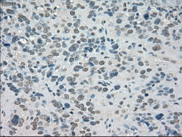 SATB1 Antibody in Immunohistochemistry (Paraffin) (IHC (P))